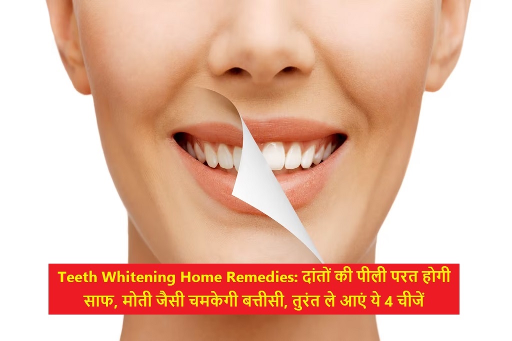 Teeth Whitening Home Remedies