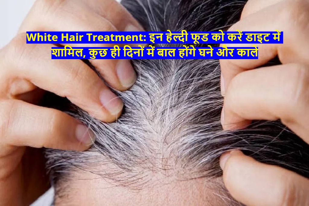 White Hair Treatment