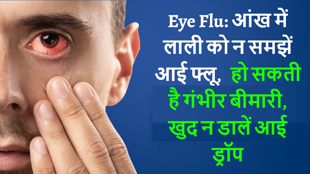 Eye Flu