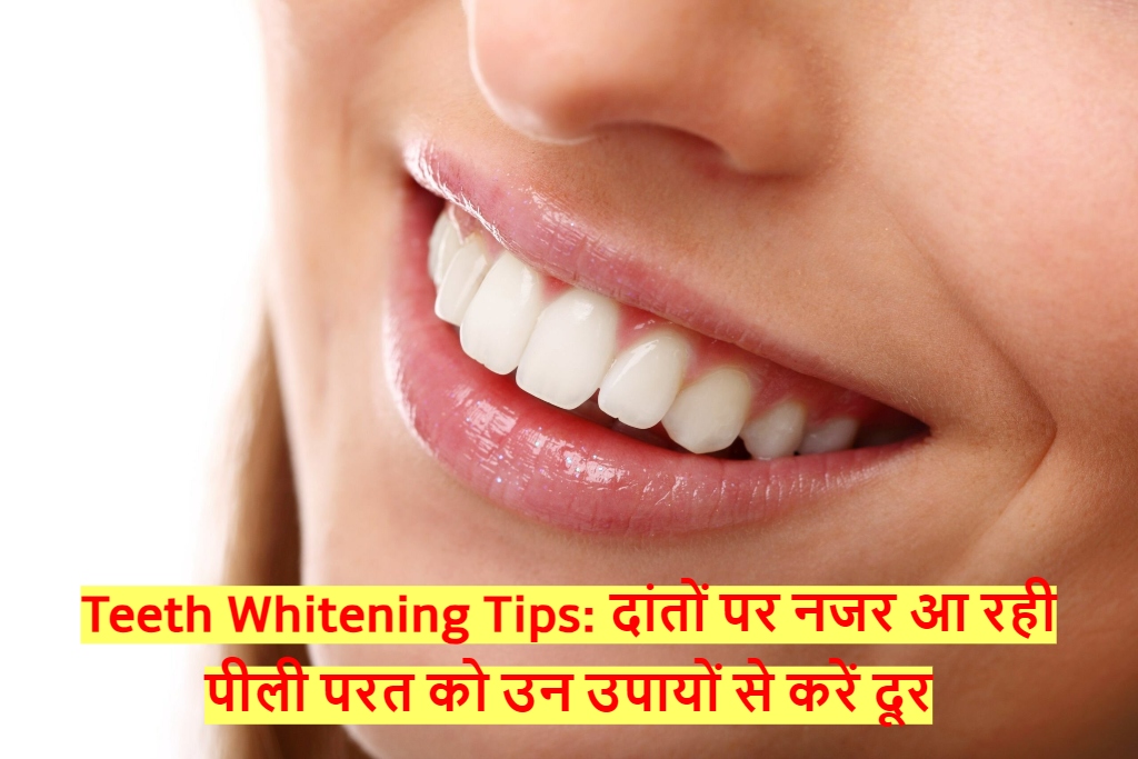 Teeth Whitening Tips