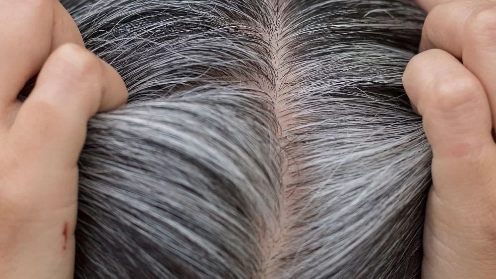 White Hair Home Remedies