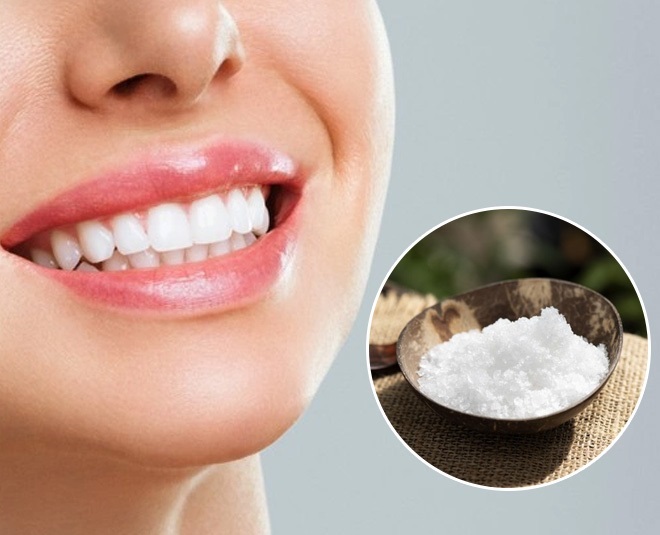 Teeth Whitening At Home